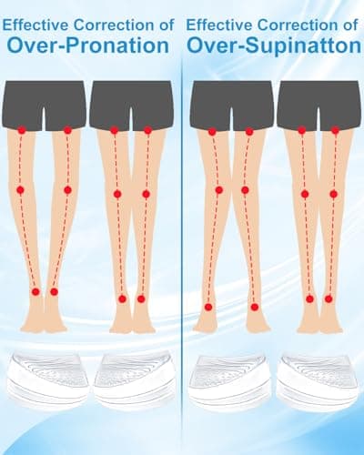 PGRODE 2 Pairs Foot Supination Correction Insoles, 3 Layers Adjustable Silicone Medial Lateral Heel Wedge, Over-Pronation Corrective Inserts for Women Men Feet Alignment, Bow Legs, Knee Pain (L)